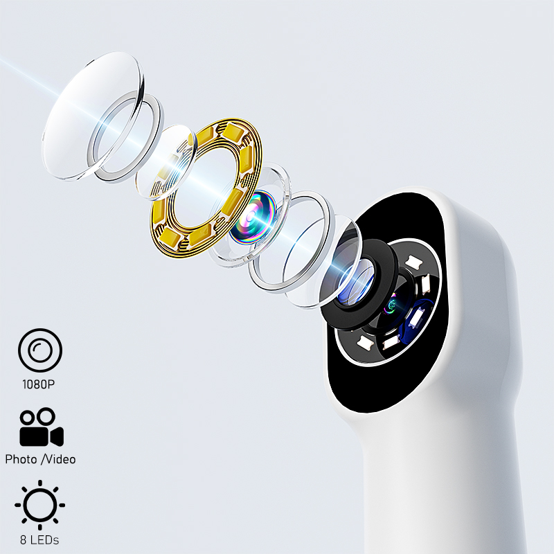 กล้องตรวจช่องปากไร้สายแบบพกพาส - Lighting Visual บทวิจารณ์และราคา
